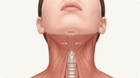 광경근 직접 교정